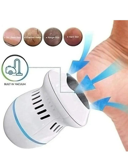 Vishou Pedi Vac for foot Callus Remover & Hard Cracked Skin Massager